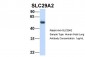 SLC29A2 antibody - C-terminal region
